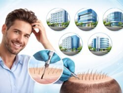 Top 5 Hair Transplant Clinic in Noida
