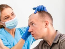 Hair Transplant in Turkey vs India: Which Country Is Best for You?
