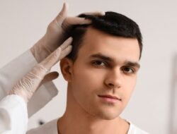 Hair Transplant Clinics in Delhi: A Definitive Guide to Excellence