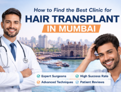 How to Find the Best Clinic for Hair Transplant in Mumbai