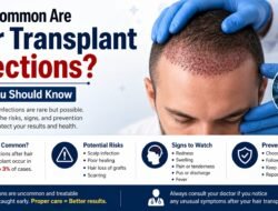 How Common Are Hair Transplant Infections? Risks You Should Know