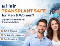 Is Hair Transplant Safe for Men & Women?