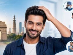 Top 5 Reasons to Choose Delhi for Your Hair Transplant