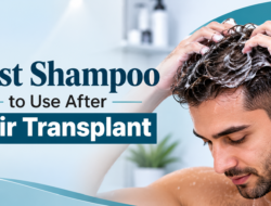 Best Shampoo to Use After Hair Transplant